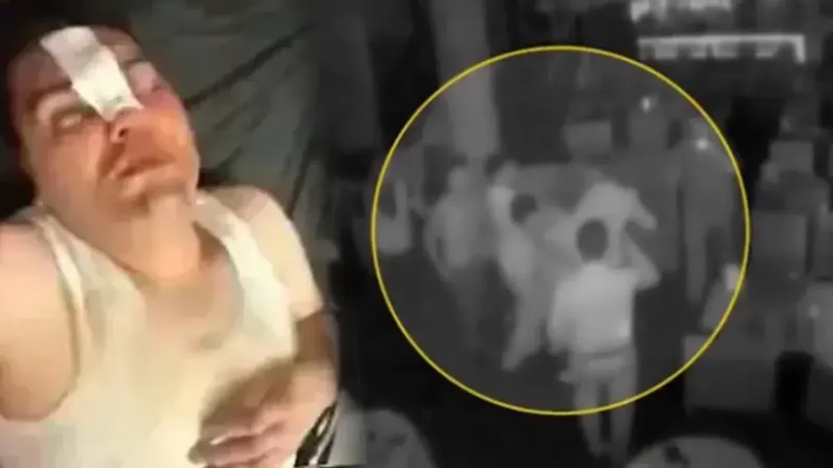Hesaba itiraz etti darp edildi… ‘Çerezi beraber, dayağı tek yedim’